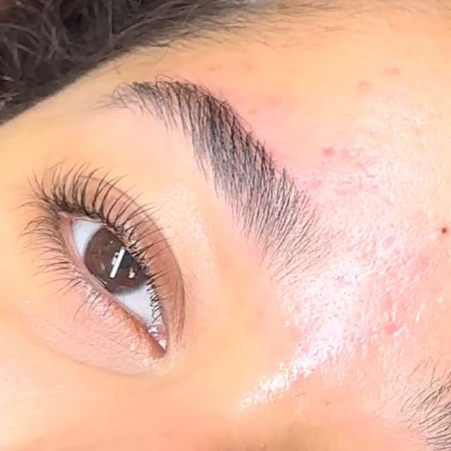 The Natural Glow Package 🤍 at YVM Aesthetics in Rockaway NJ, NJ